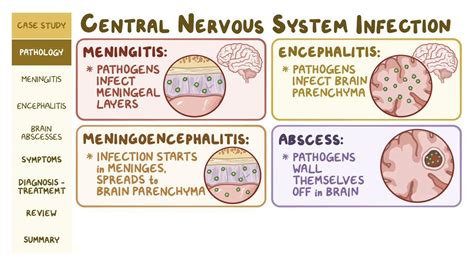 Inf1 Infections of Nervous System GENERAL