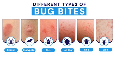 Infected insect bite: Pictures, symptoms, treatment, and more