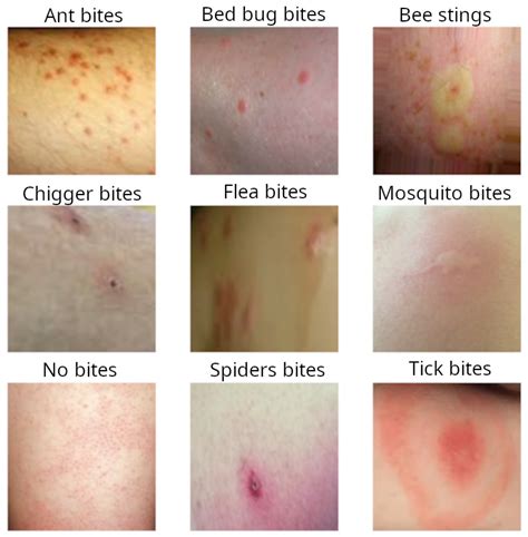 WebMD and Everyday Health both provide slideshows displaying photos of insect bites with helpful information to enable identification of the biting insect based on the appearance o.... 