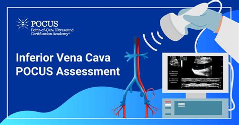 Inferior Vena Cava POCUS Assessment of Inferior …