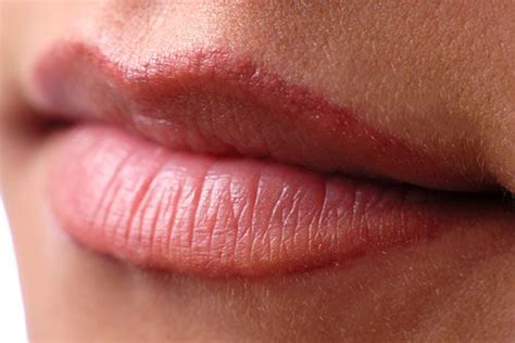 Inflamed Lips after drinking alcohol - Steady. Health