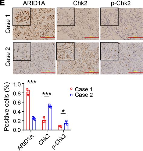 Inhibition of the ATM/Chk2 axis promotes cGAS/STING signaling ... - PubMed