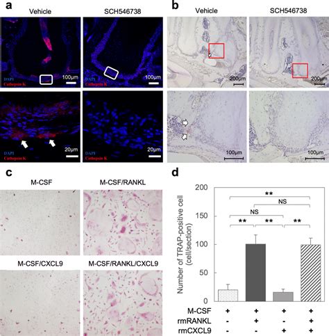 Inhibition of the CXCL9-CXCR3 axis suppresses the progression …