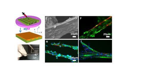 Injectable cell carriers for cell delivery in skeletal muscle tissue