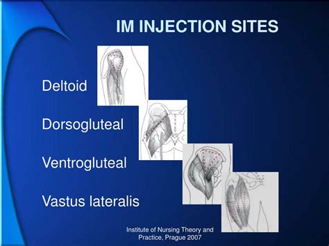 Injections - SlideShare