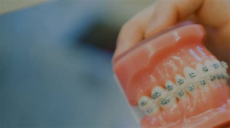 Innovative orthodontics. Things To Know About Innovative orthodontics. 