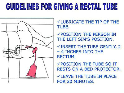 Inserting a rectal tube. .  <a href=https://crm.wisedigitalpartners.com/...
