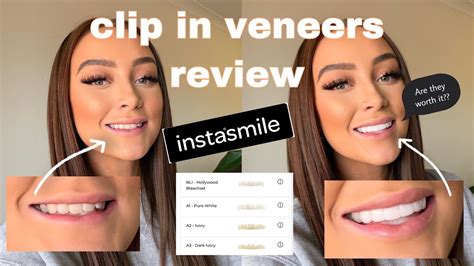 <strong>Instasmile</strong> clip-on veneers cost from £400 per arch to cover missing teeth, so are £1,000's cheaper. . Instasmile