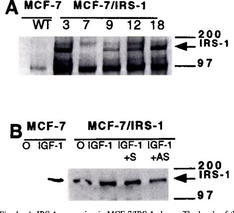 Insulin receptor substrate 1 knockdown in human MCF7 ER