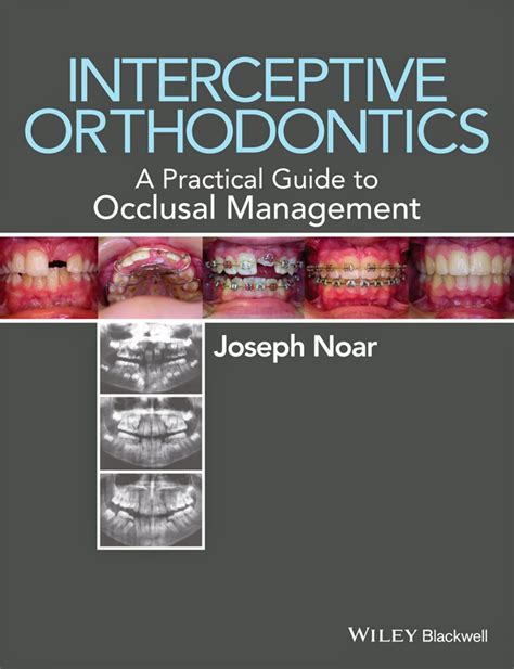 Interceptive orthodontics a practical guide to occlusal management by joseph noar 2014 08 29. - Upright mx19 scissor lift parts manual.