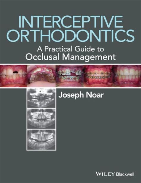 Interceptive orthodontics a practical guide to occlusal management by noar joseph 2014 paperback. - Guide de lecture des cartes anciennes.