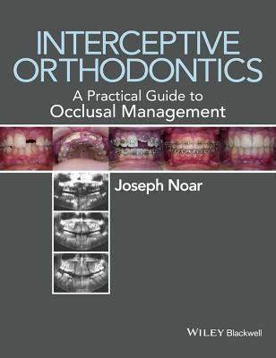 Read Online Interceptive Orthodontics A Guide To The Developing Dentition By Joseph Noar