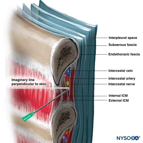 Intercostal nerve block cpt. Things To Know About Intercostal nerve block cpt. 