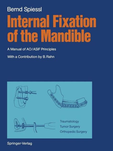 Internal fixation of the mandible a manual of ao asif principles. - Die historie von der schönen lau..