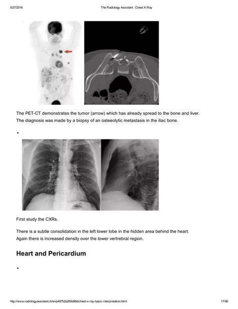 Interpretation: This study demonstrates