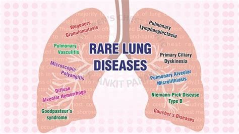 Interstitial lung disease - About the Disease - Genetic and Rare ...