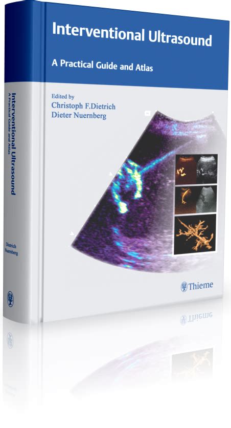 Interventional Ultrasound A Practical Guide And Atlas