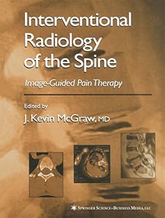 Interventional radiology of the spine image guided pain therapy reprint. - Dialekt- und ausländertypen des älteren englischen dramas.