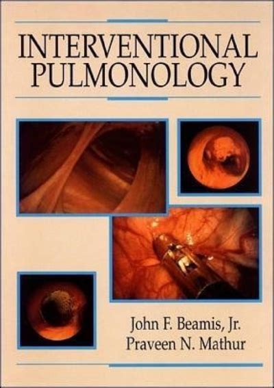 Read Online Interventional Pulmonology By John F Beamis Jr
