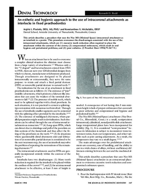 Intracoronal esthetic splinting - PubMed