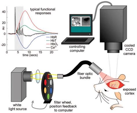 Intrinsic Signal Optical Imaging (ISOI): State-of-the-Art ... - Springer