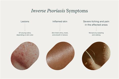 Invers psoriasis bilder