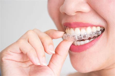 Get Invisalign cleaner to clean it perfectly