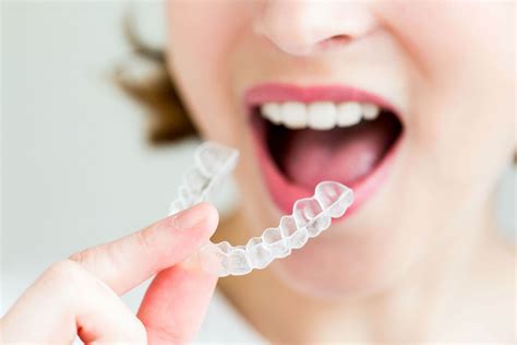 Feb 2, 2023 · Invisalign Maker Align Tech Catapults 27% On Its 'Rosy Vision' For 2023. Align Technology ( ALGN) painted a "rosy vision" for 2023, an analyst said Thursday, as ALGN stock launched to its highest ... . 