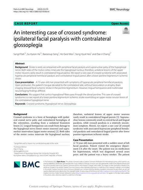 Ipsilateral Glossoplegia & Hemiplegia: Acute Medullary