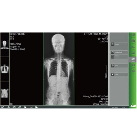 Iray technology. 7125 Providing a Total Solution for all your X-Ray System needs The iRay detect...
