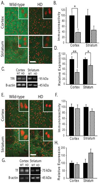 Iron Accumulates in Huntington’s Disease Neurons: Protection