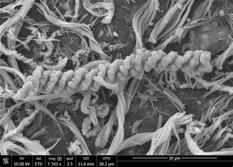 Iron-Fueled Life in the Continental Subsurface: Deep Mine …