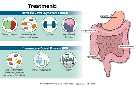 Irritable Bowel Syndrome (IBS) Treatment & Management