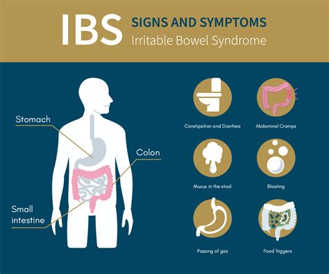 Full Download Irritable Bowel Syndrome By Netce