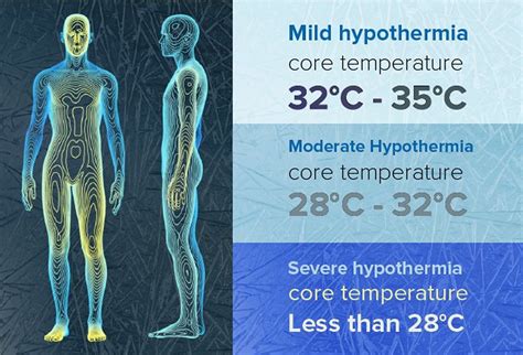 Is 32 Celsius hypothermia