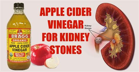 Is Apple Cider Bad For Kidneys - HealthyKidneyClub.com