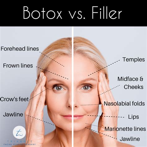 Is Botox or fillers better for under eye wrinkles?