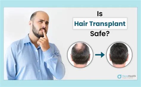 Is Hair Transplant Safe? - Risks, Safety and Complications