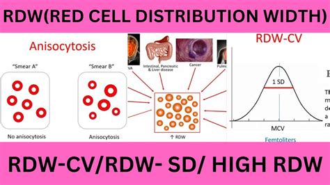 Is RDW CV 14.7 high, normal or dangerous? What does RDW CV