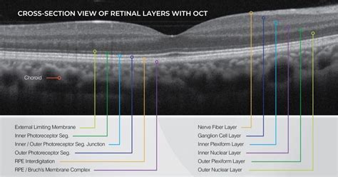 Is it worth getting a retinal scan
