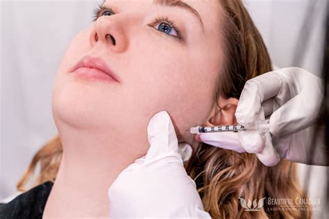 I’ve been looking into masseter Botox, it see