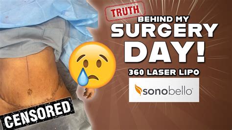 Nov 13, 2019 ... Sono Bello laser liposuction testimonials from real Sono Bello patients. Patients talk about their amazing body and life changing results .... 