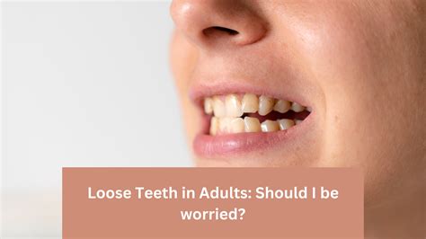 Is there a phobia of wobbly teeth? – Sage-Advices