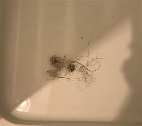 Is this amount of shedding normal? Haven’t washed my hair in 3 …