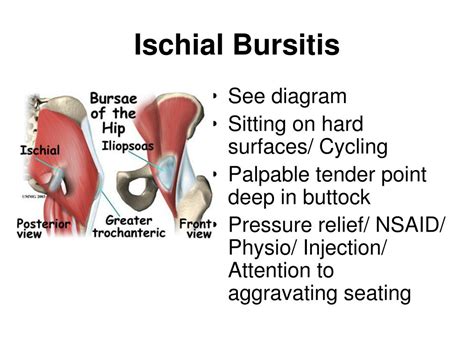 Medically Reviewed on 5/9/2023. References. Hip bursitis results when the fluid-filled sac (bursa) near the hip becomes inflamed due to localized soft tissue trauma or strain. Symptoms include stiffness and pain around the hip joint. Hip bursitis can be treated with ice compresses, rest, and anti-inflammatory and pain medications.. 