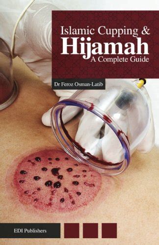 Islamic cupping hijamah a complete guide by osman latib dr feroz 2013 paperback. - Numerical methods for engineers 5th edition solution manual free download.