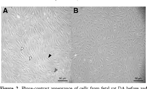 Isolation and Culture of Fibroblasts, Vascular Smooth Muscle, …