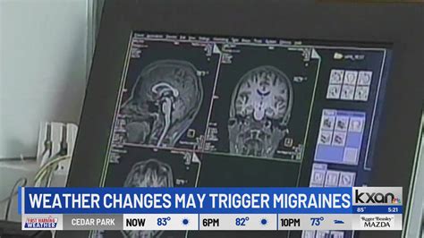 It's not allergies: Seasonal changes, weather could trigger migraines