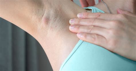 Itchy armpits and cancer Is there a link 