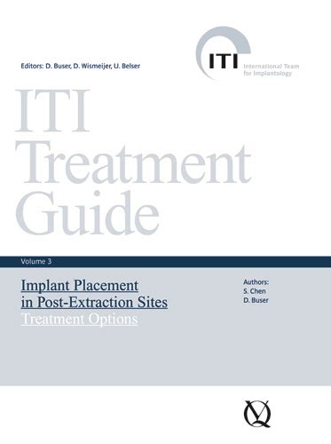 Iti treatment guide volume 3 implant placement in post extraction sites treatment options iti treatment guides. - Willekeurige afdanking in belgisch, nederlands en frans sociaal recht.